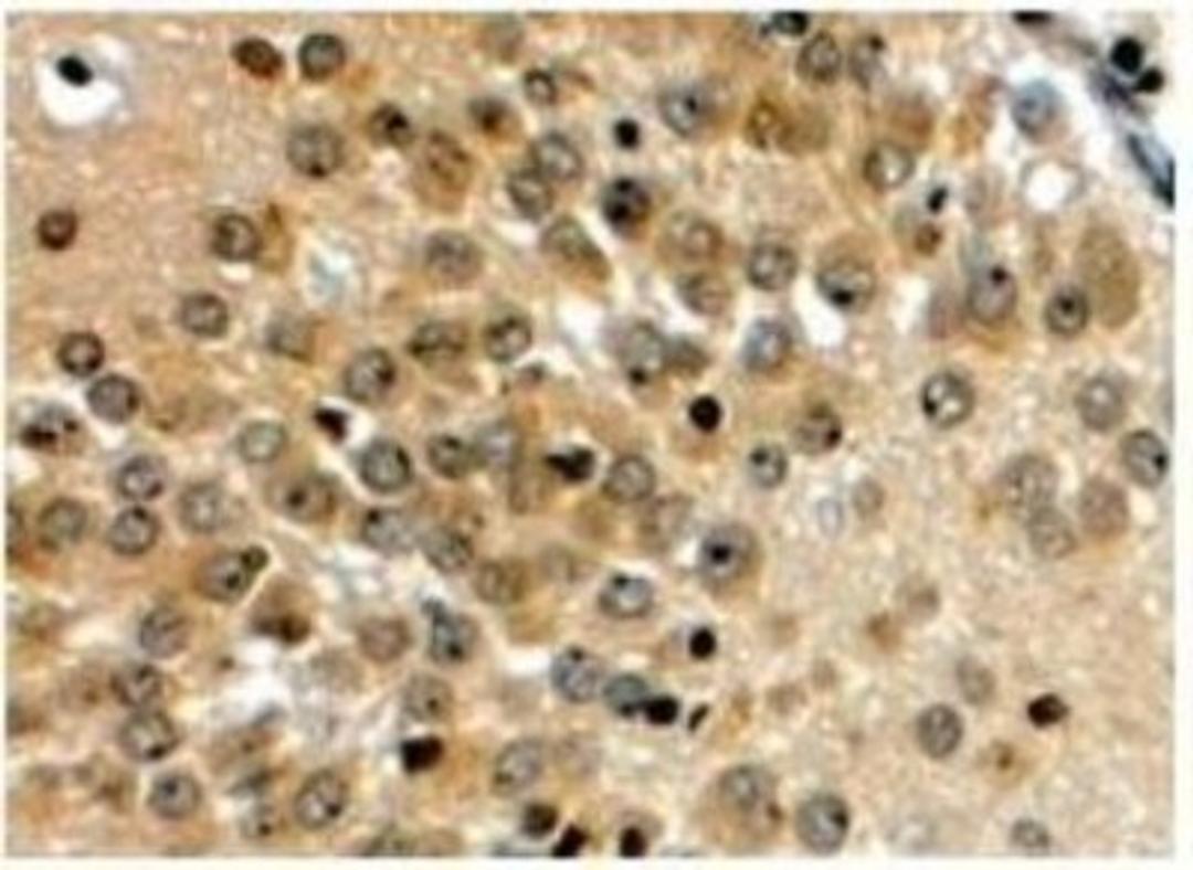 Immunohistochemistry-Paraffin: Notch3 Antibody [NB100-2414] - Staining of paraffin embedded Human Hippocampus. Steamed antigen retrieval with citrate buffer pH 6, HRP-staining.