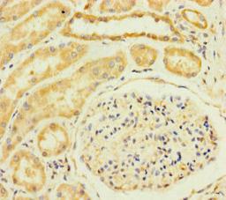 Immunohistochemistry of paraffin-embedded human kidney tissue using CSB-PA863106LA01HU at dilution of 1:100