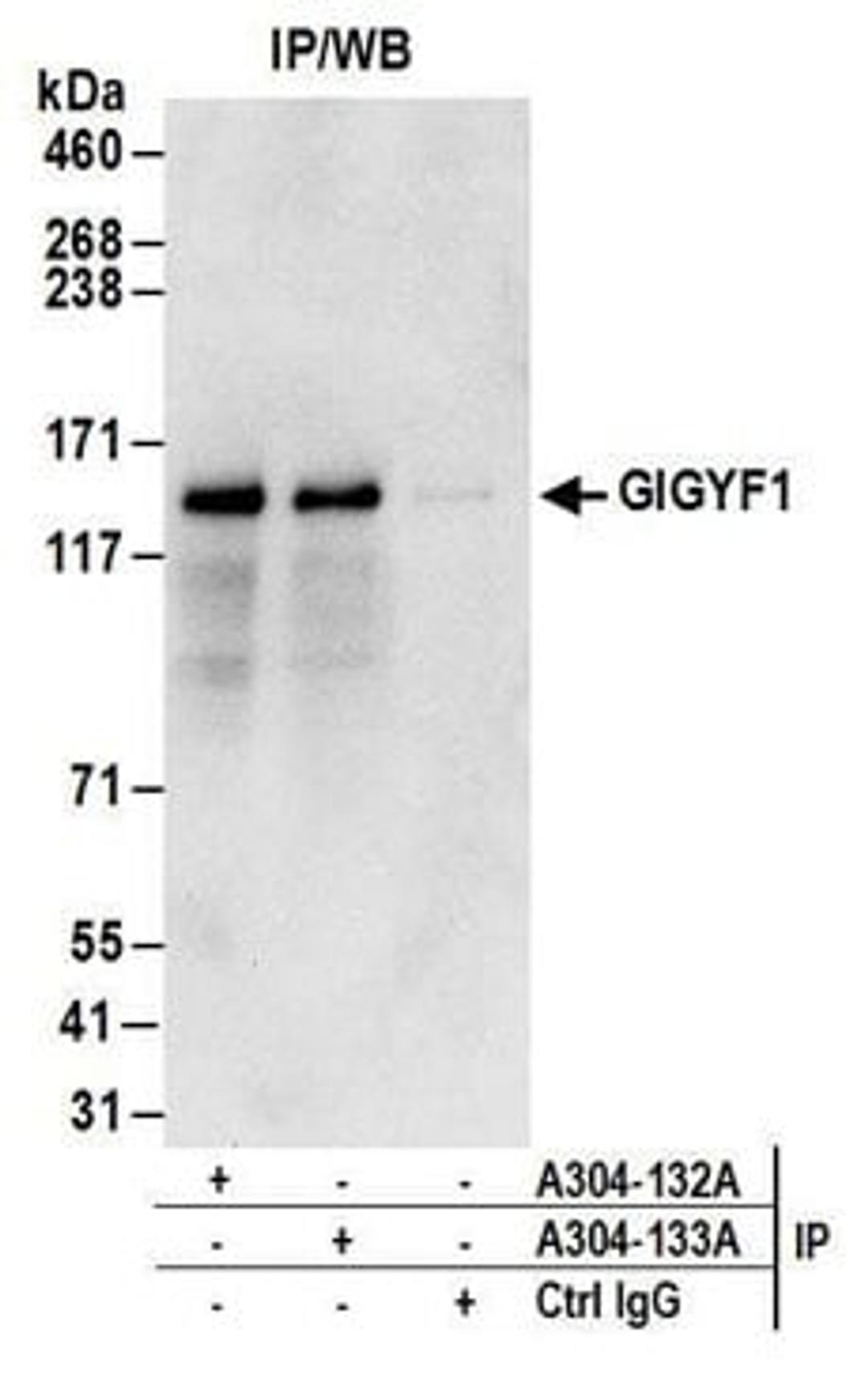 Detection of human GIGYF1 by western blot of immunoprecipitates.