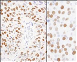 Detection of human and mouse Phospho MCM2 (S108) by immunohistochemistry.