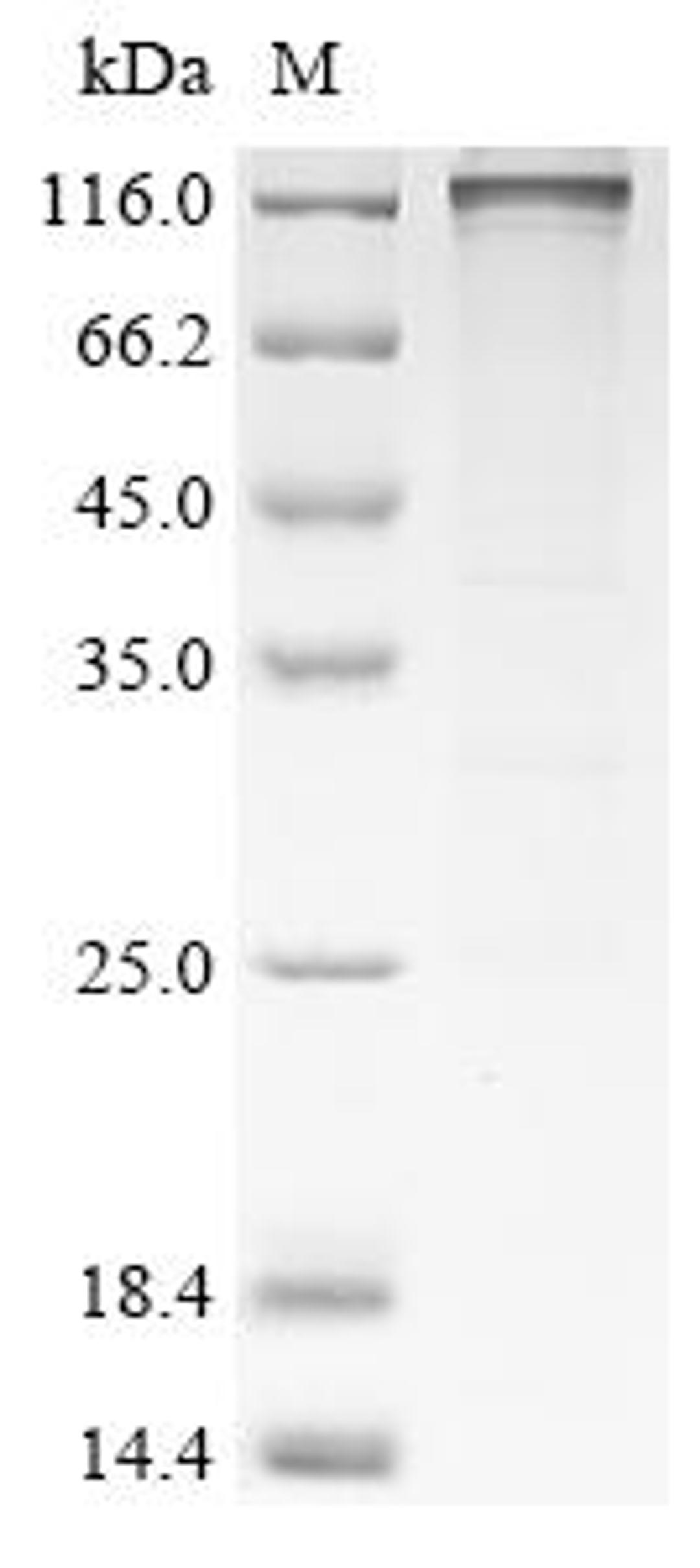 (Tris-Glycine gel) Discontinuous SDS-PAGE (reduced) with 5% enrichment gel and 15% separation gel.