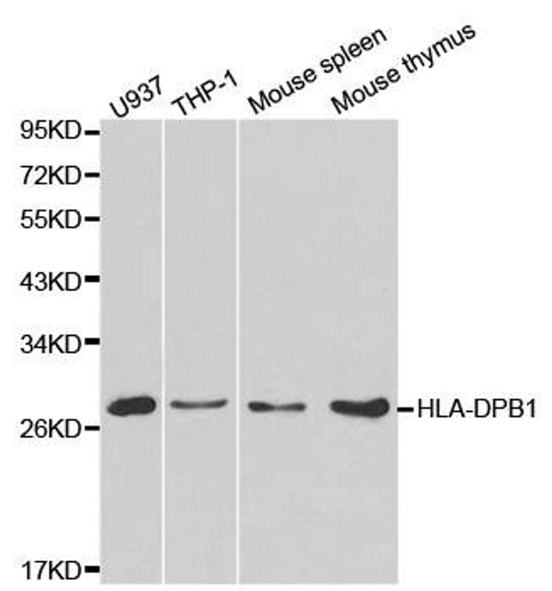 WB analysis of extracts of various cell lines using HLA-DPB1 antibody