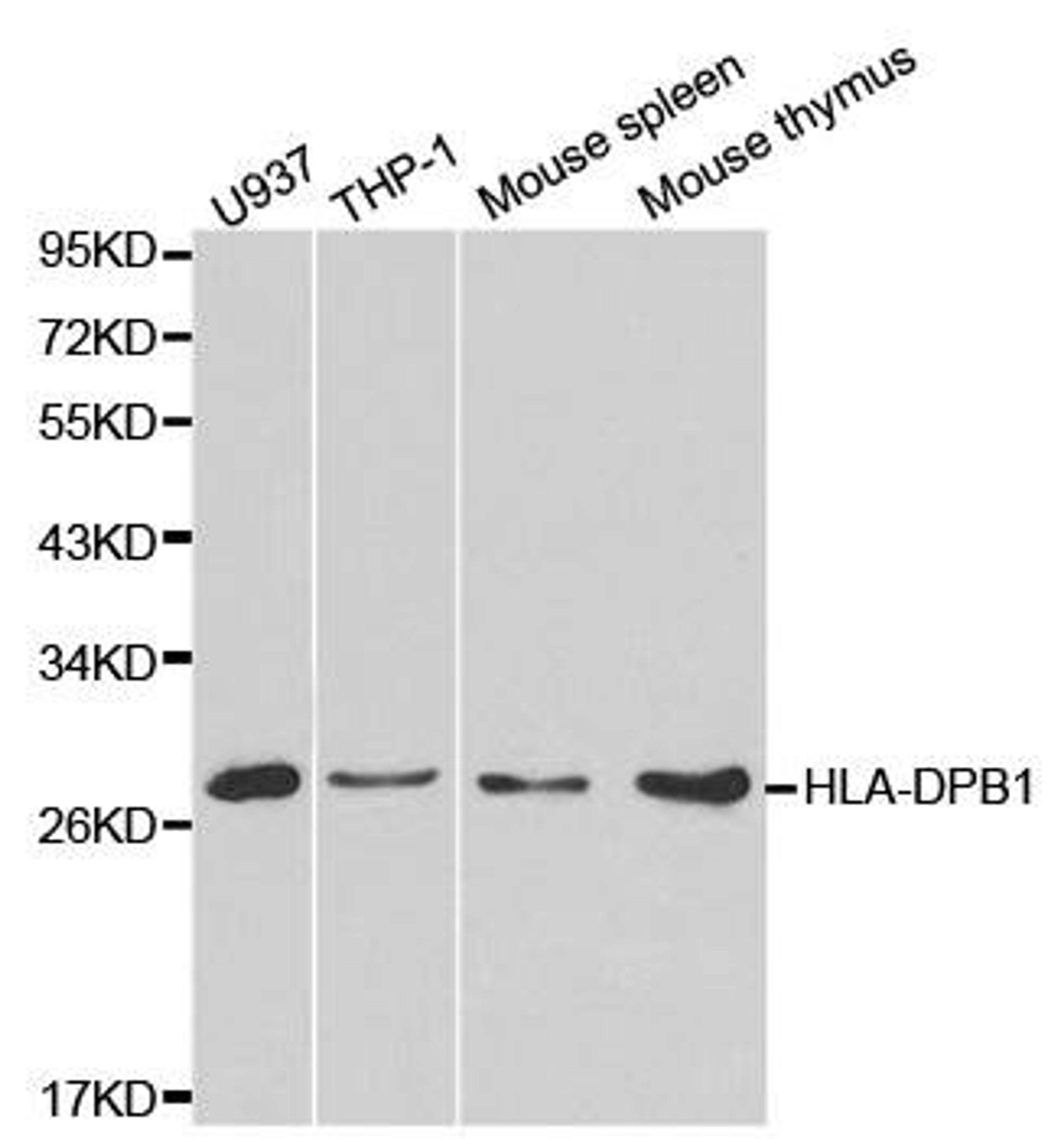 WB analysis of extracts of various cell lines using HLA-DPB1 antibody