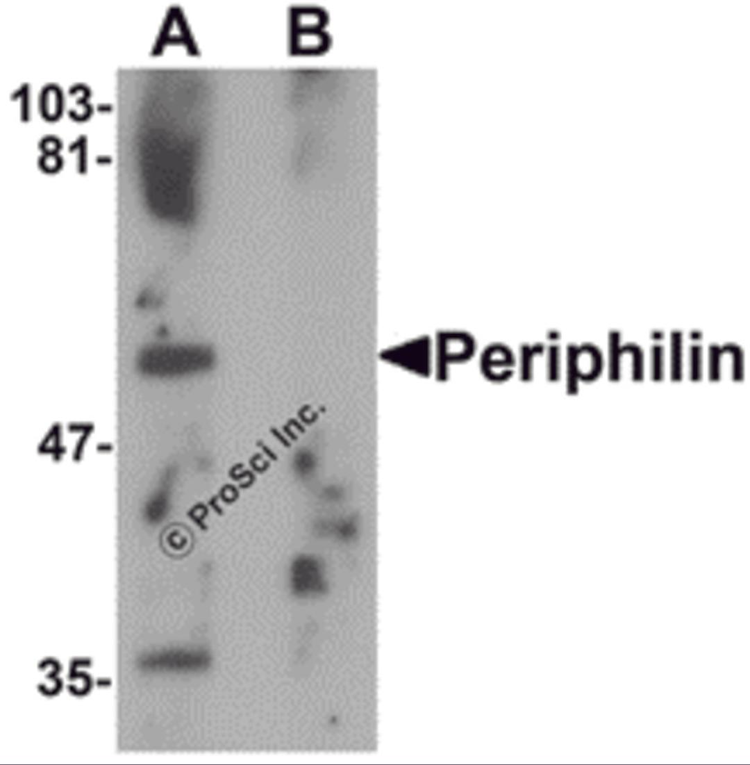 Western blot analysis of Periphilin in mouse colon tissue lysate with Periphilin antibody at 1 μg/mL in (A) the absence and (B) the presence of blocking peptide.