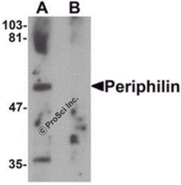 Western blot analysis of Periphilin in mouse colon tissue lysate with Periphilin antibody at 1 μg/mL in (A) the absence and (B) the presence of blocking peptide.