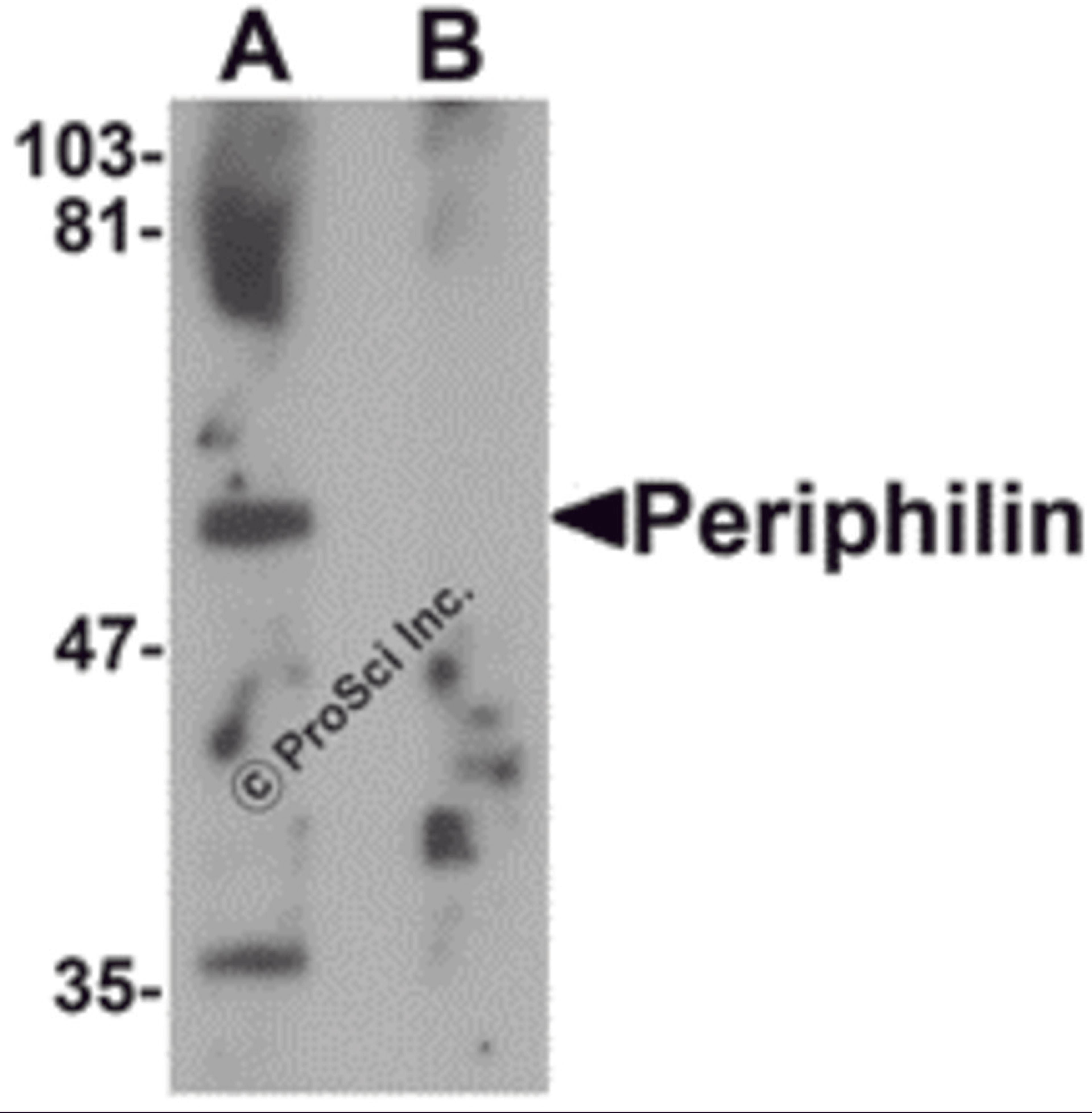 Western blot analysis of Periphilin in mouse colon tissue lysate with Periphilin antibody at 1 μg/mL in (A) the absence and (B) the presence of blocking peptide.