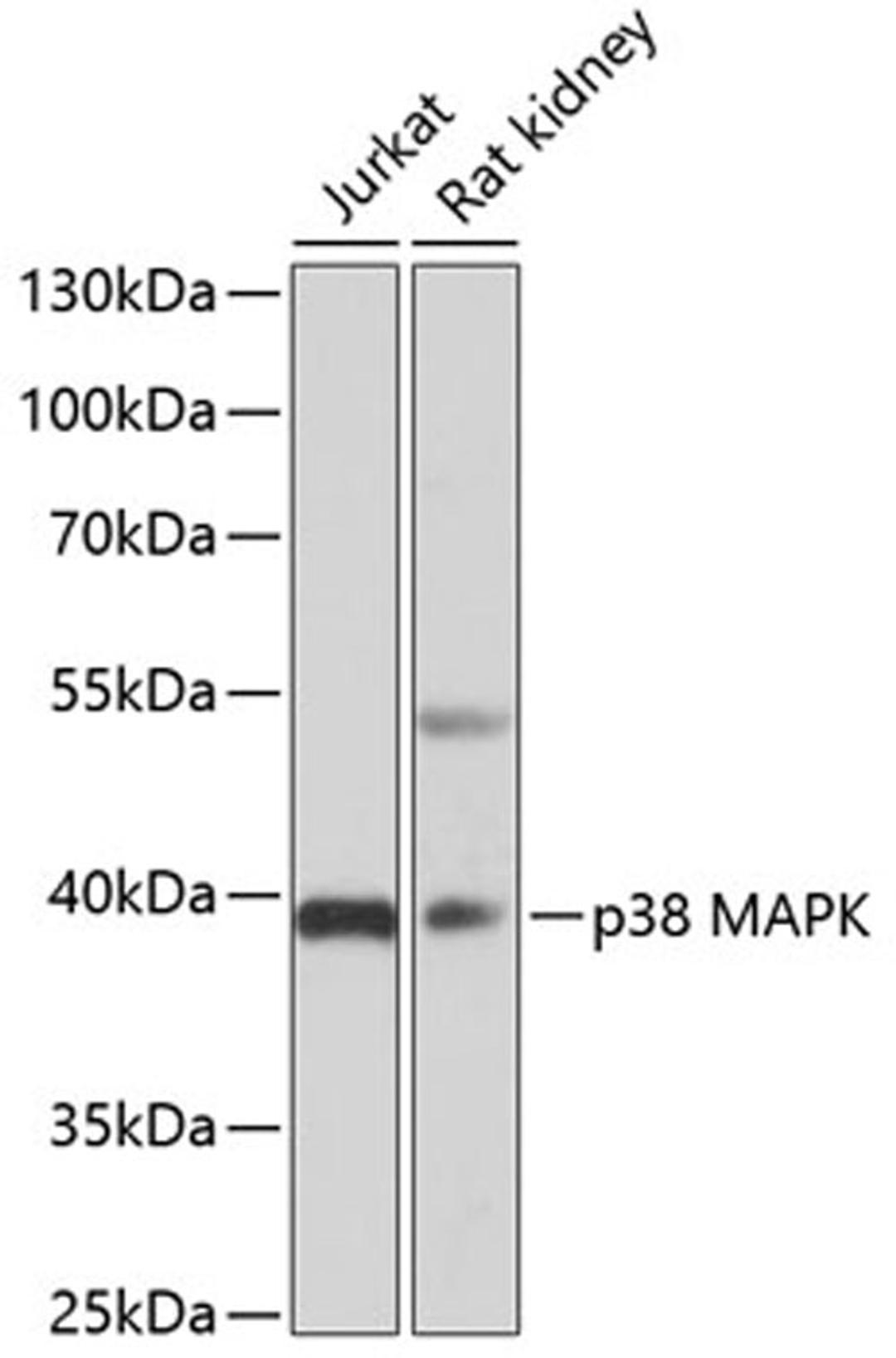 Western blot - p38 MAPK antibody (A5521)