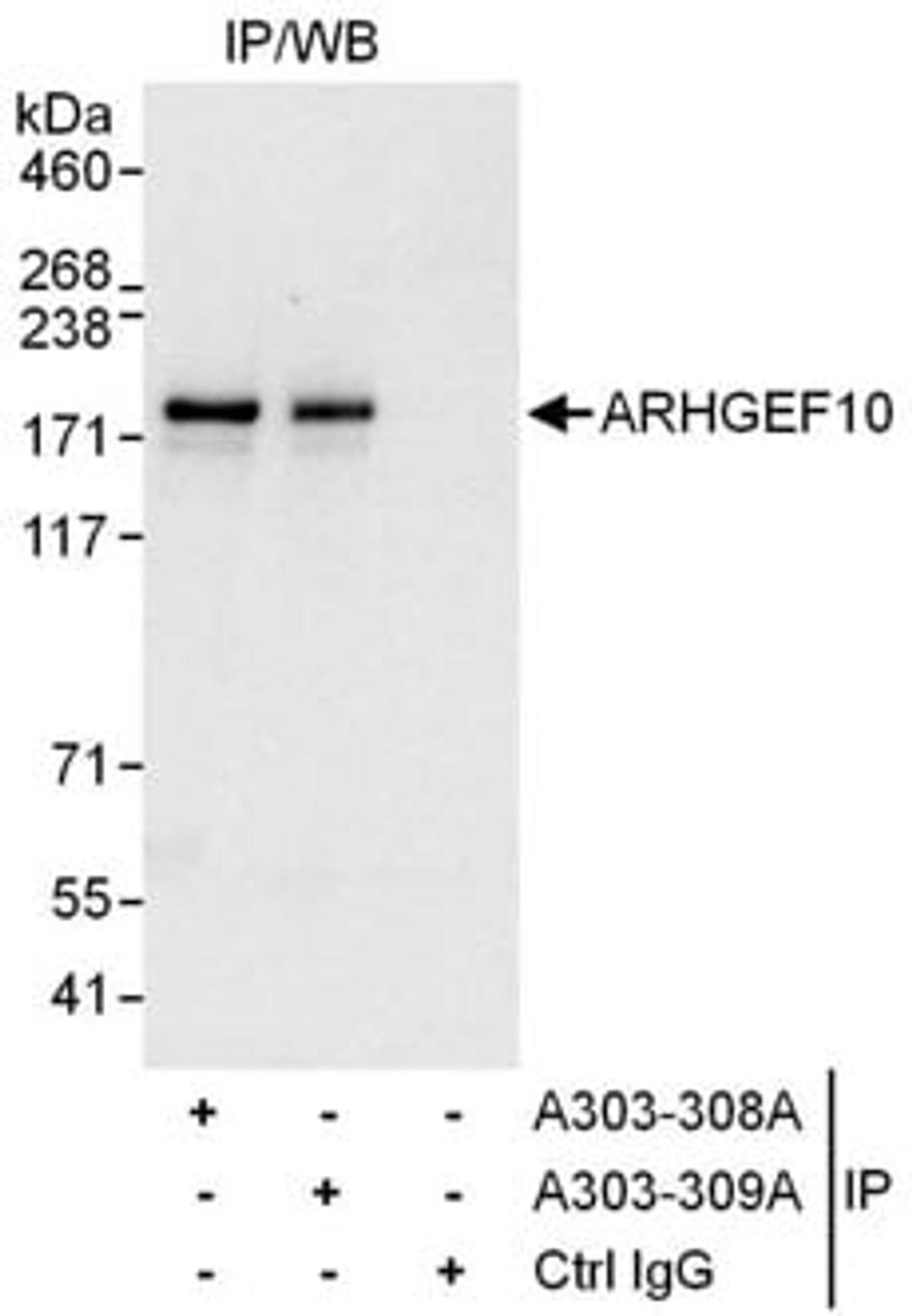 Detection of human ARHGEF10 by western blot of immunoprecipitates.