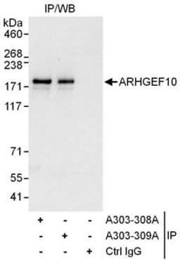 Detection of human ARHGEF10 by western blot of immunoprecipitates.