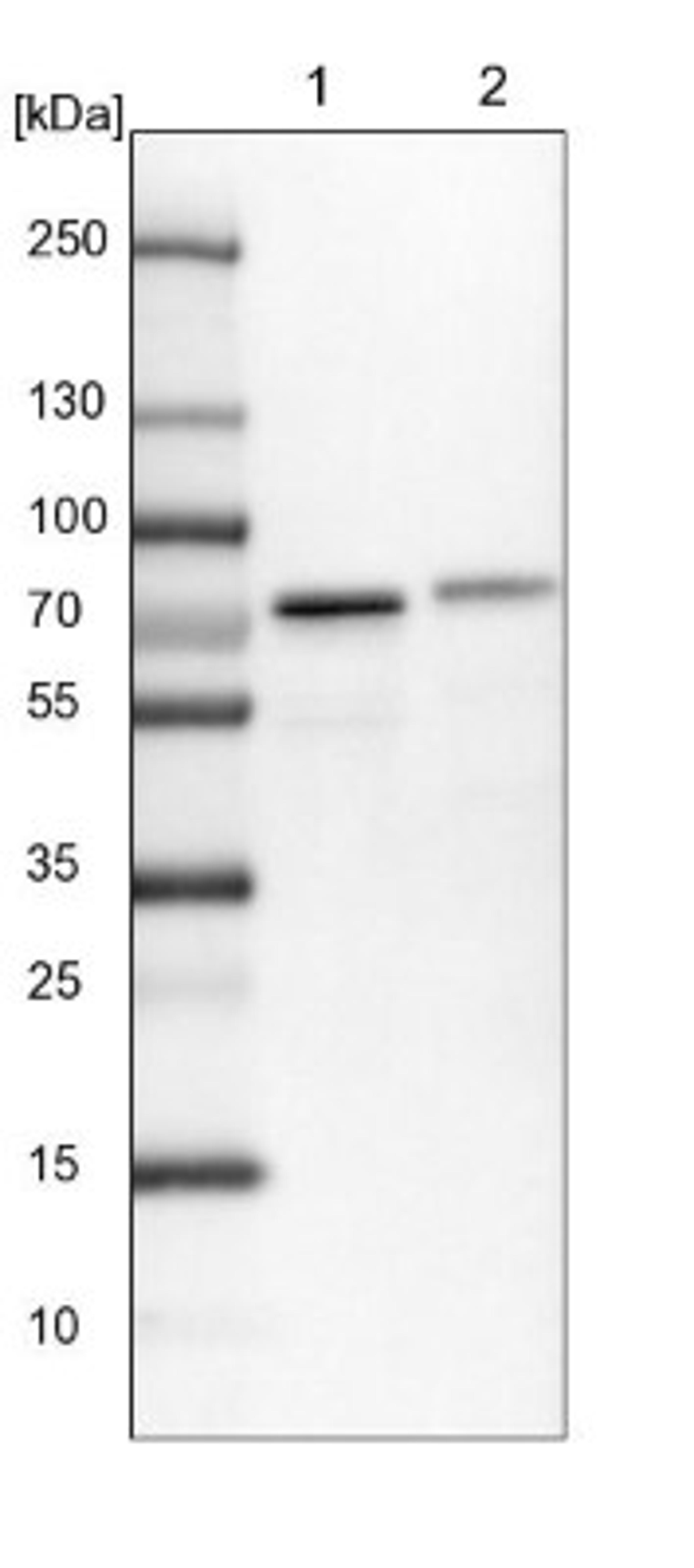 Western Blot: Clathrin interactor 1 Antibody [NBP1-85570] - Lane 1: NIH-3T3 cell lysate (Mouse embryonic fibroblast cells)<br/>Lane 2: NBT-II cell lysate (Rat Wistar bladder tumour cells)