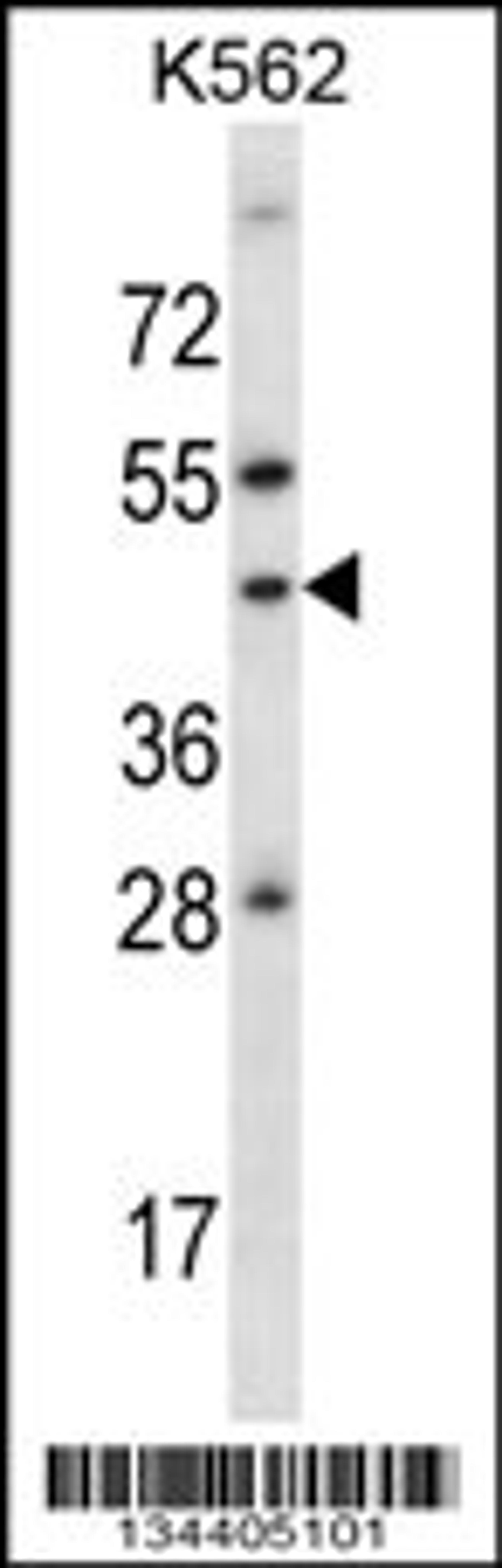 Western blot analysis in K562 cell line lysates (35ug/lane).