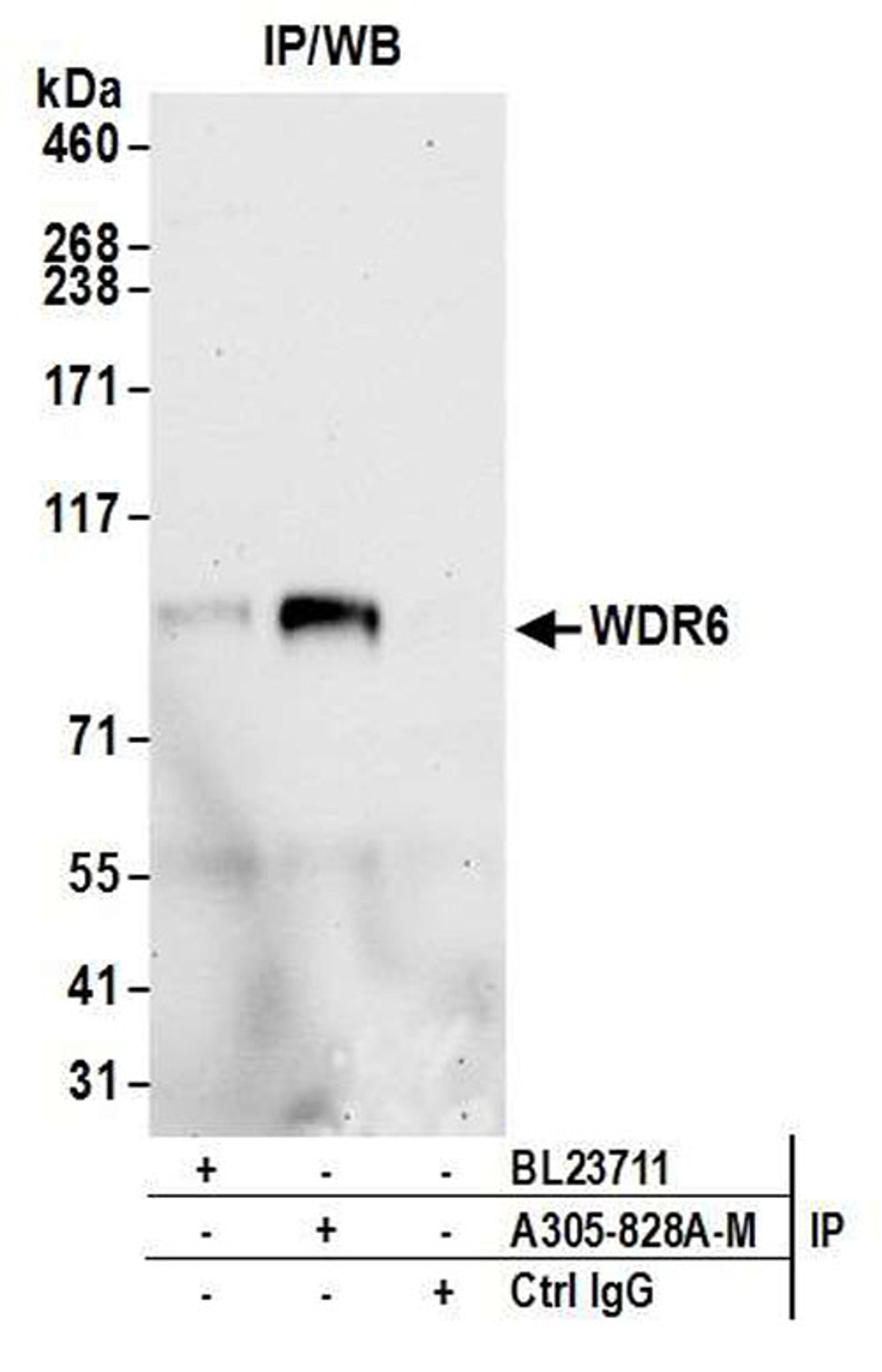 Detection of human WDR6 by WB of IP.