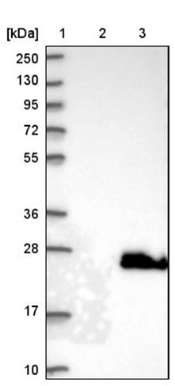 Western Blot: BAALC Antibody [NBP1-89443] - Lane 1: Marker [kDa] 250, 130, 95, 72, 55, 36, 28, 17, 10<br/>Lane 2: Negative control (vector only transfected HEK293T lysate)<br/>Lane 3: Over-expression lysate (Co-expressed with a C-terminal myc-DDK tag (~3.1 kDa) in mammalian HEK293T cells, LY403032)