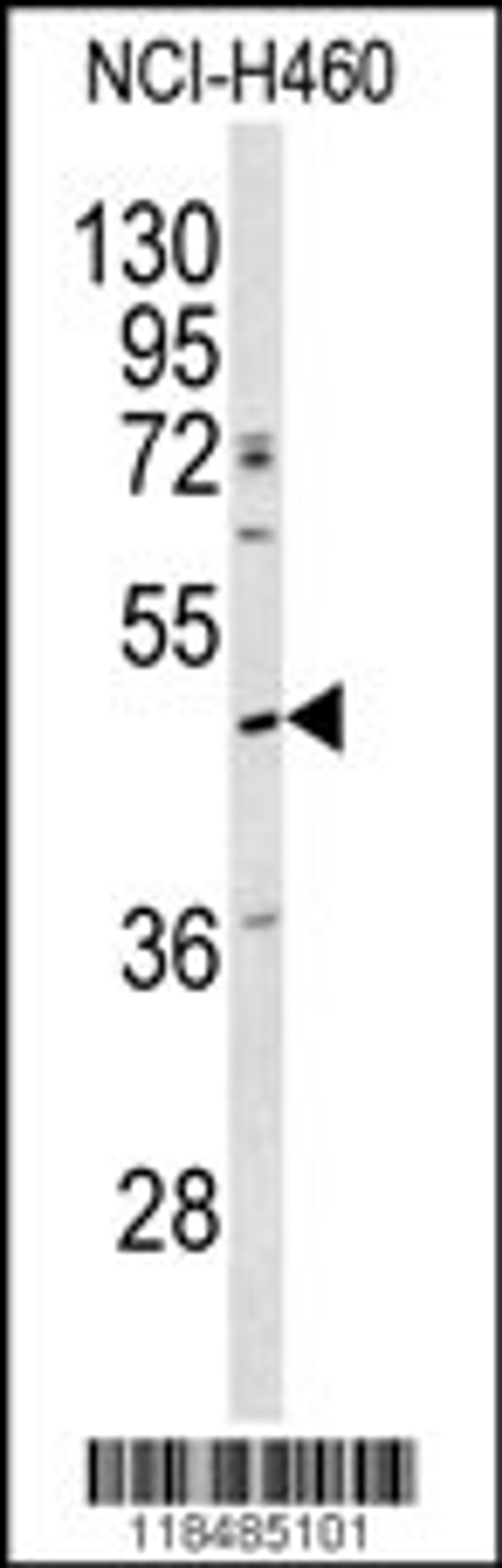 Western blot analysis of SERPINA4 antibody in NCI-H460 cell line lysates (35ug/lane)