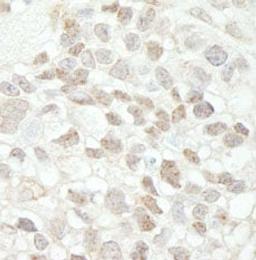 Detection of human MED18 by immunohistochemistry.