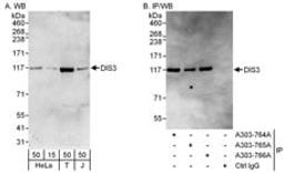 Detection of human DIS3 by western blot and immunoprecipitation.