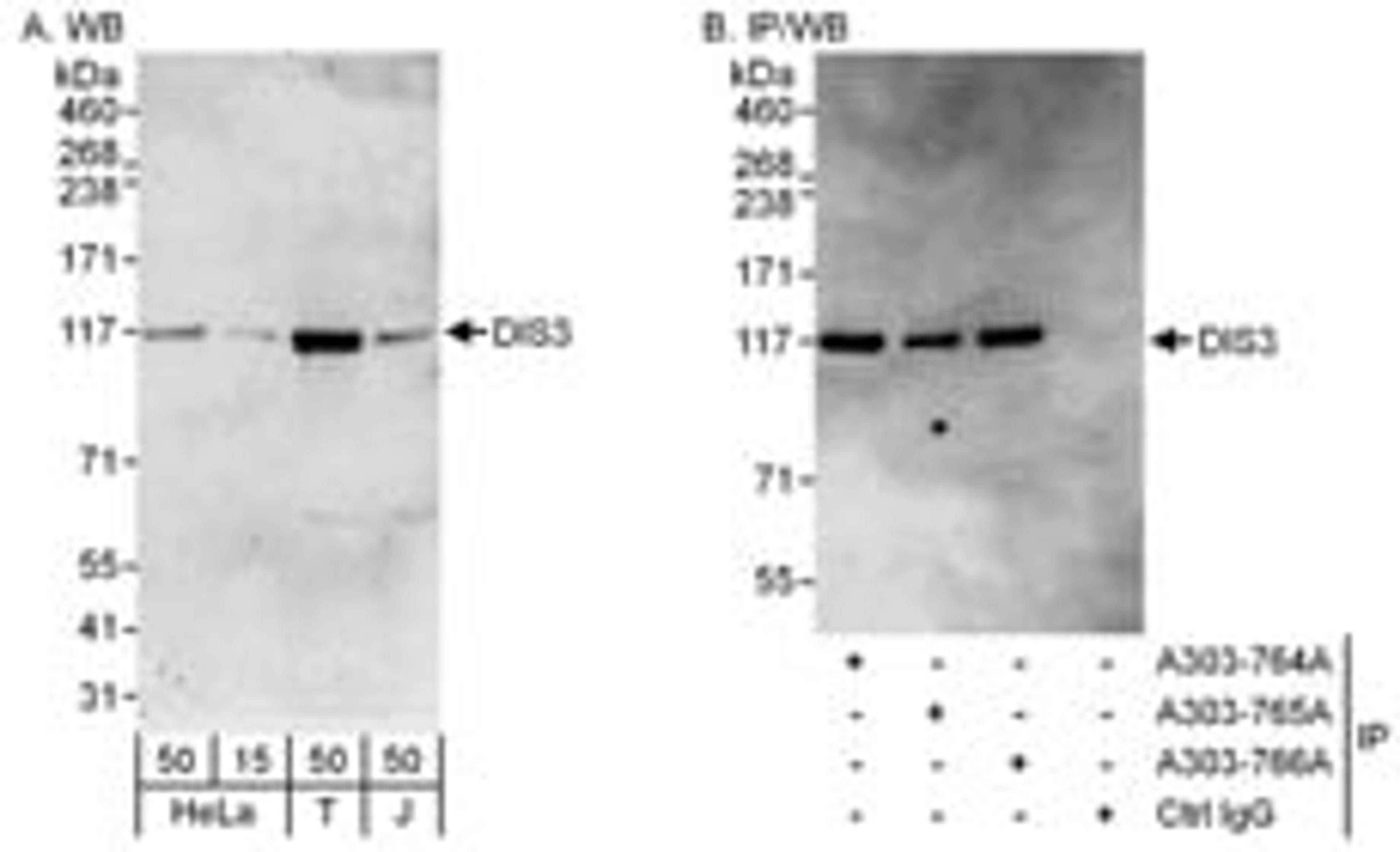 Detection of human DIS3 by western blot and immunoprecipitation.