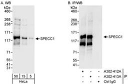 Detection of human SPECC1 by western blot and immunoprecipitation.