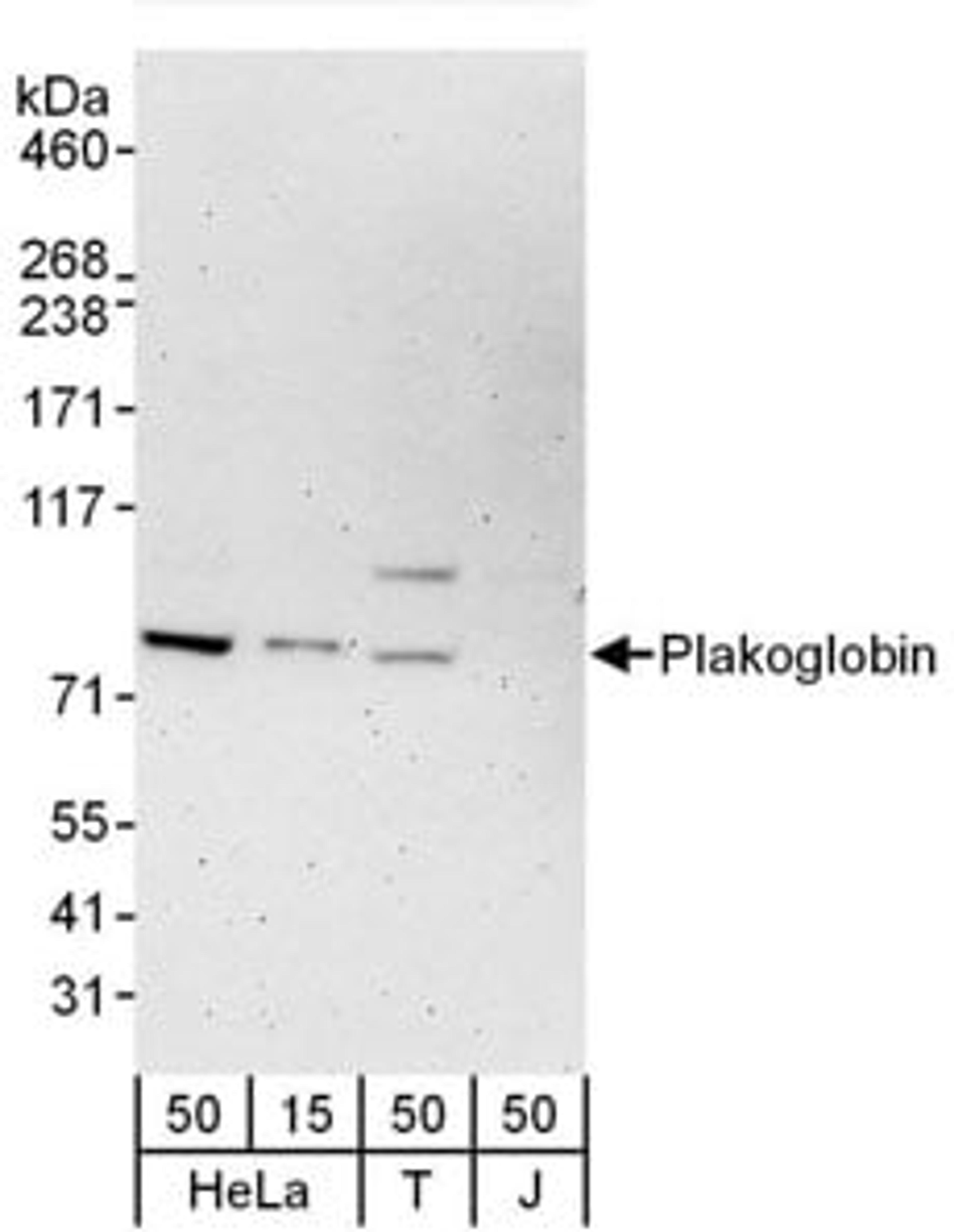 Detection of human Plakoglobin by western blot.