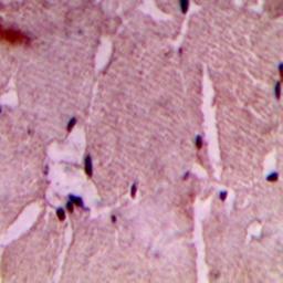 Immunohistochemical analysis of formalin-fixed and paraffin-embedded human heart tissue using COX7A2/3 antibody