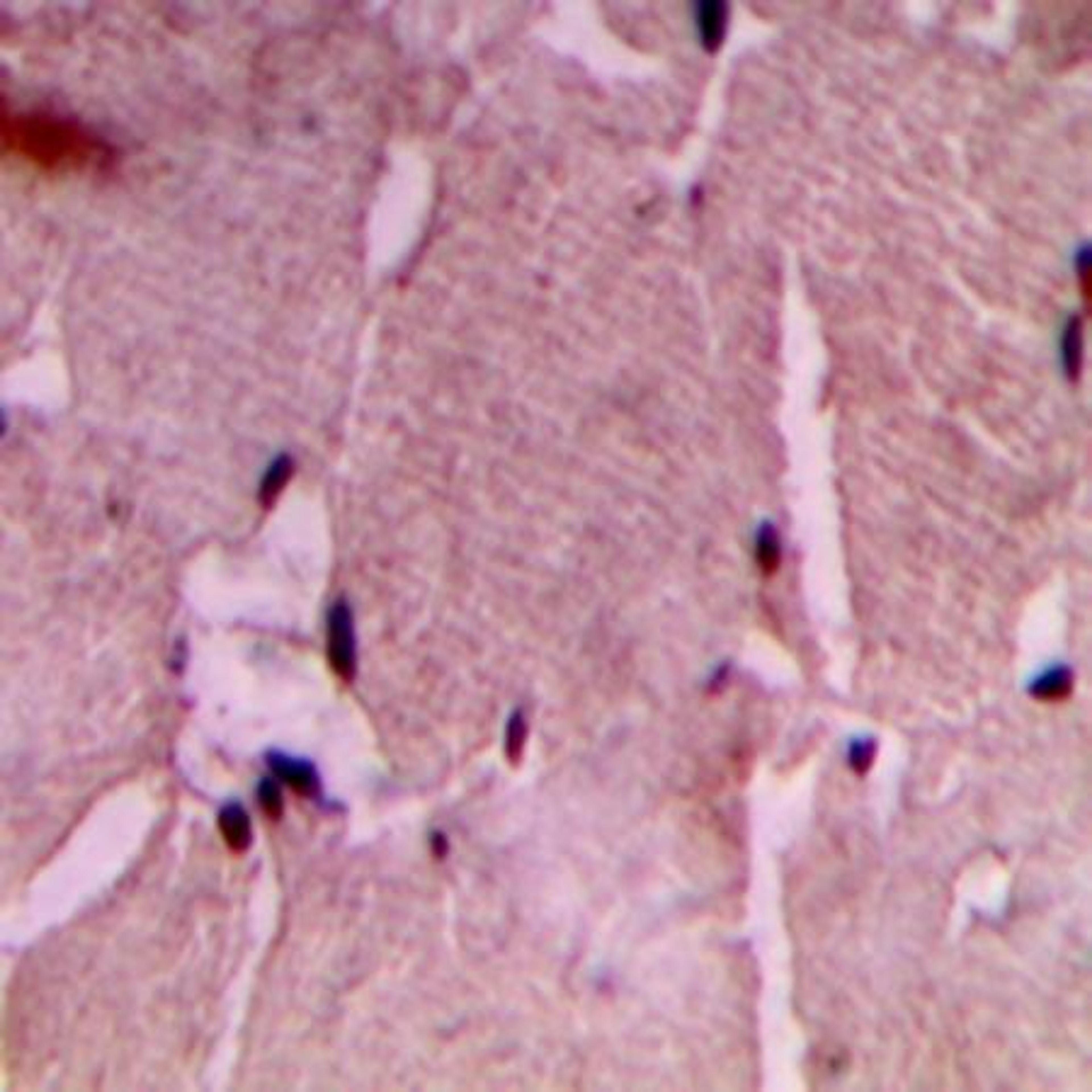 Immunohistochemical analysis of formalin-fixed and paraffin-embedded human heart tissue using COX7A2/3 antibody