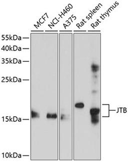 Western blot - JTB antibody (A10427)