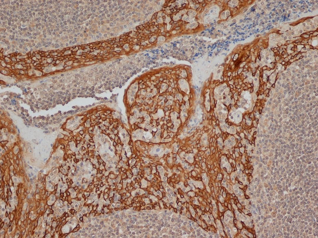 Immunoperoxidase staining of FFPE human tonsil with Mouse anti Human cytokeratin 14