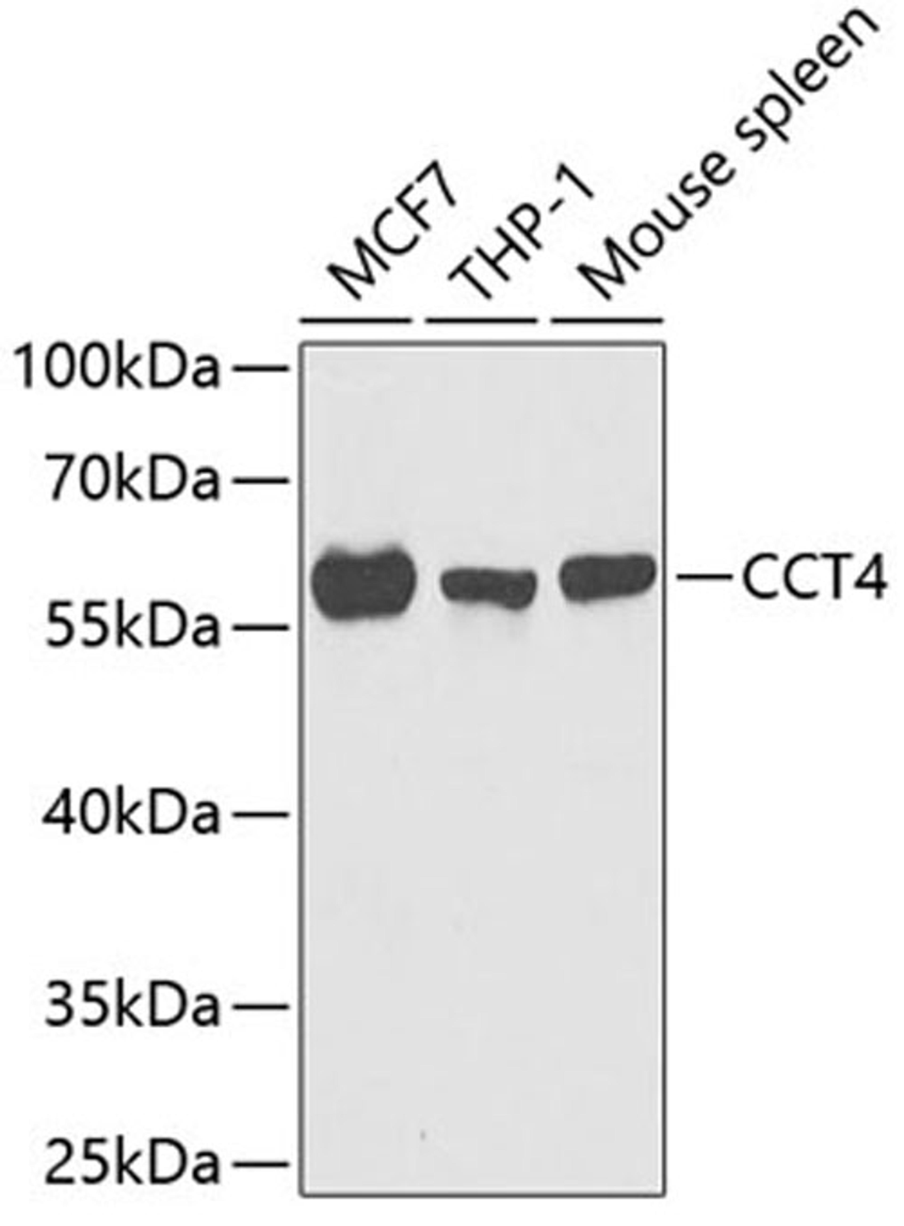 Western blot - CCT4 antibody (A6548)