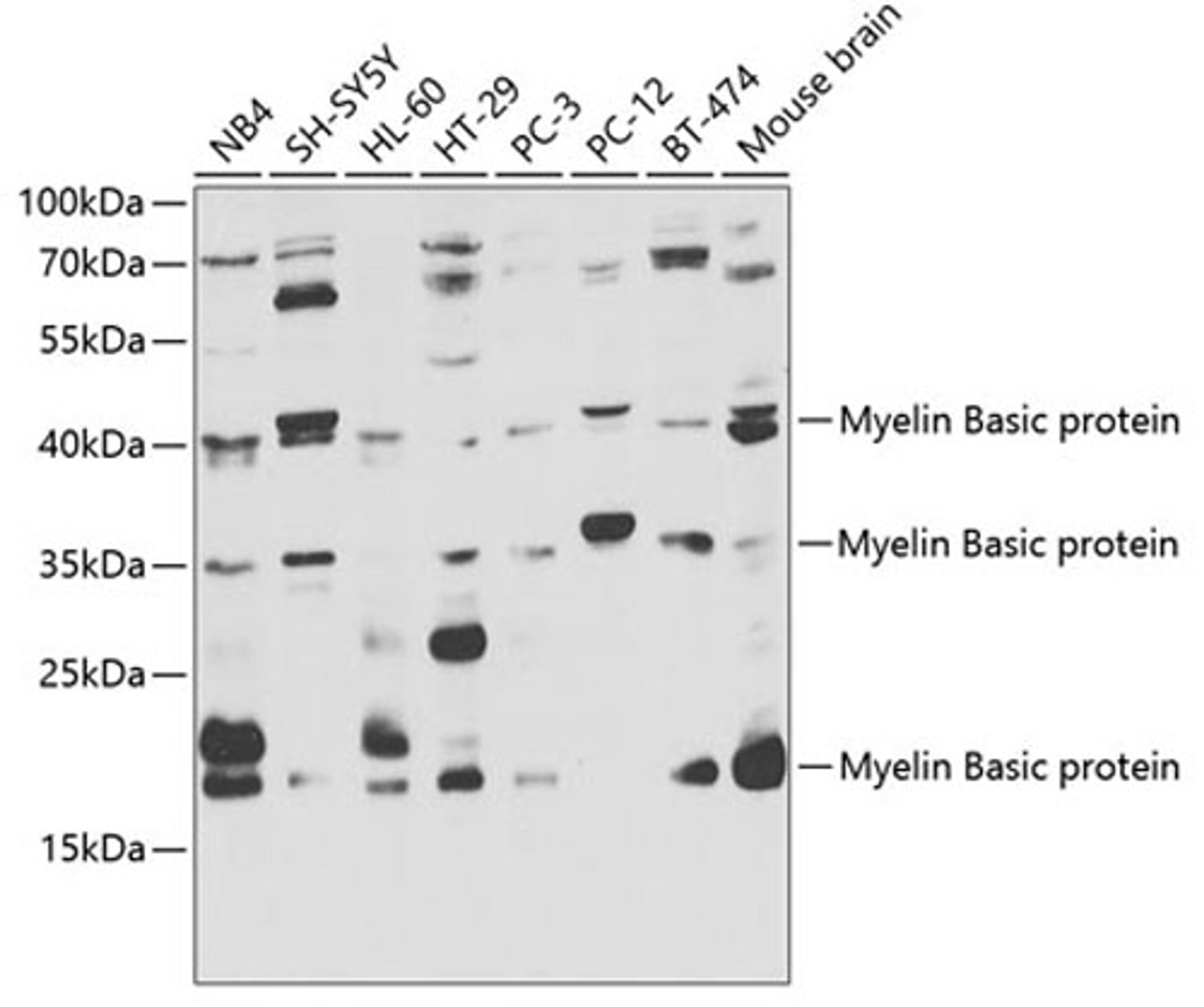 Western blot - Myelin Basic protein antibody (A1664)