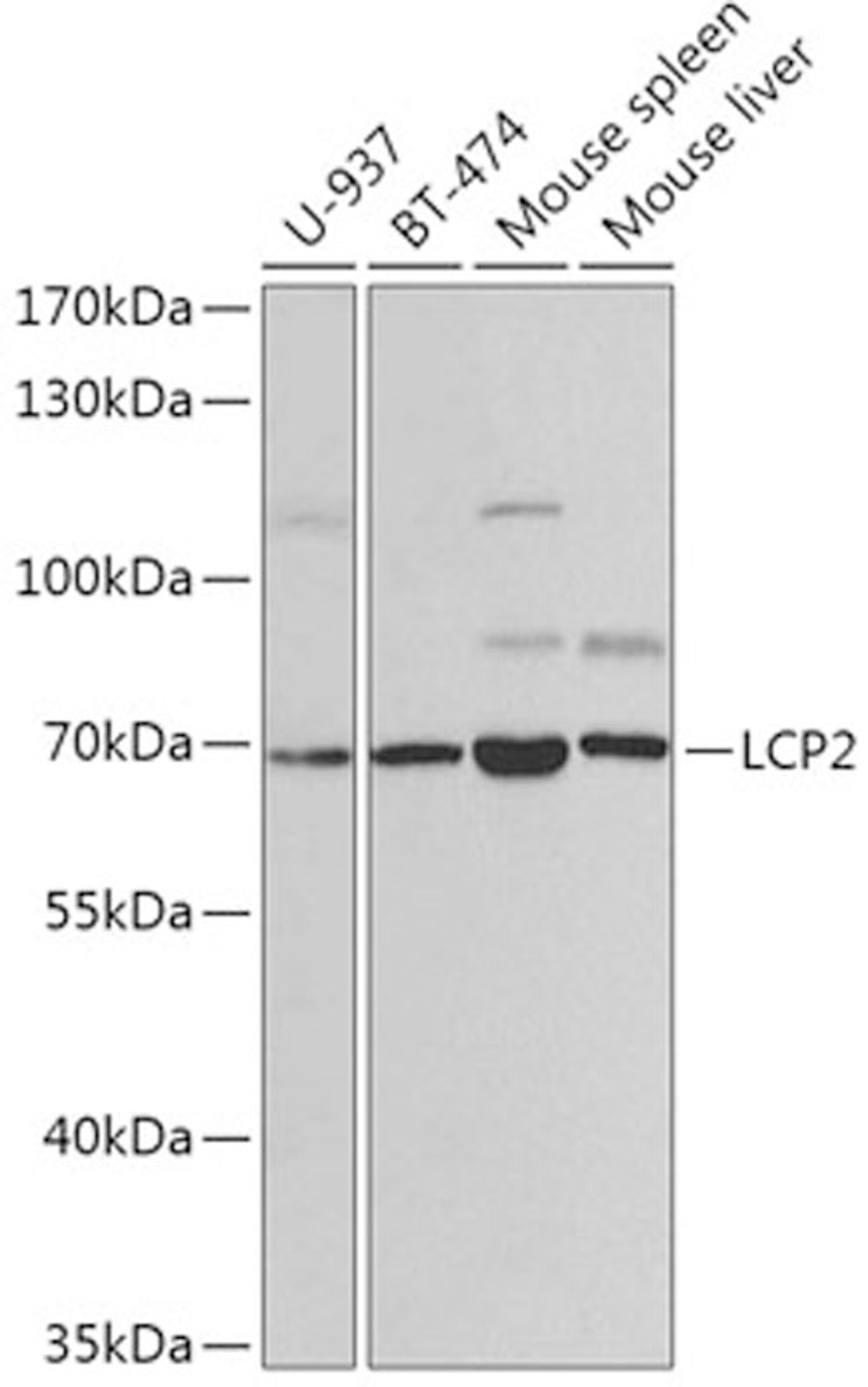 Western blot - LCP2 antibody (A2567)