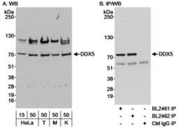 Detection of human DDX5 by western blot and immunoprecipitation.