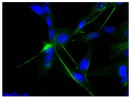 Human astrocytoma cell line CCF-STTG1 was stained with Mouse Anti-Human GFAP-UNLB (Cat. No. 99-779) followed by Rabbit Anti-Mouse IgG(H+L), Human ads-FITC and DAPI.