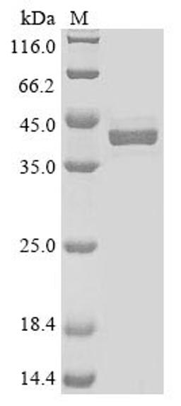(Tris-Glycine gel) Discontinuous SDS-PAGE (reduced) with 5% enrichment gel and 15% separation gel.