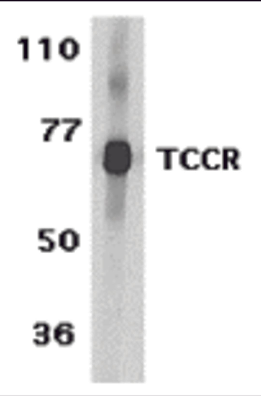 Western blot analysis of TCCR expression in human spleen tissue lysates with TCCR antibody at 1 μg /ml.