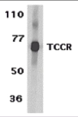 Western blot analysis of TCCR expression in human spleen tissue lysates with TCCR antibody at 1 μg /ml.