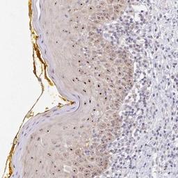 Immunohistochemistry: Pericentrin 1 Antibody [NBP2-31860] - Immunohistochemical staining of human oral mucosa shows moderate nucleolar positivity in squamous epithelial cells.