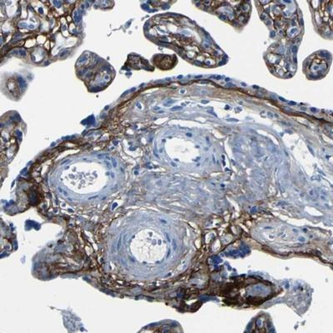 Immunohistochemistry: Fibrillin 2 Antibody [NBP1-88169] - Immunohistochemical staining of human placenta shows distinct positivity in basal membranes.