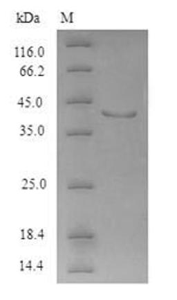 (Tris-Glycine gel) Discontinuous SDS-PAGE (reduced) with 5% enrichment gel and 15% separation gel.