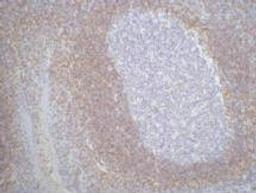 IHC staining of Human tonsil tissue paraffin-embedded, diluted at 1:200.