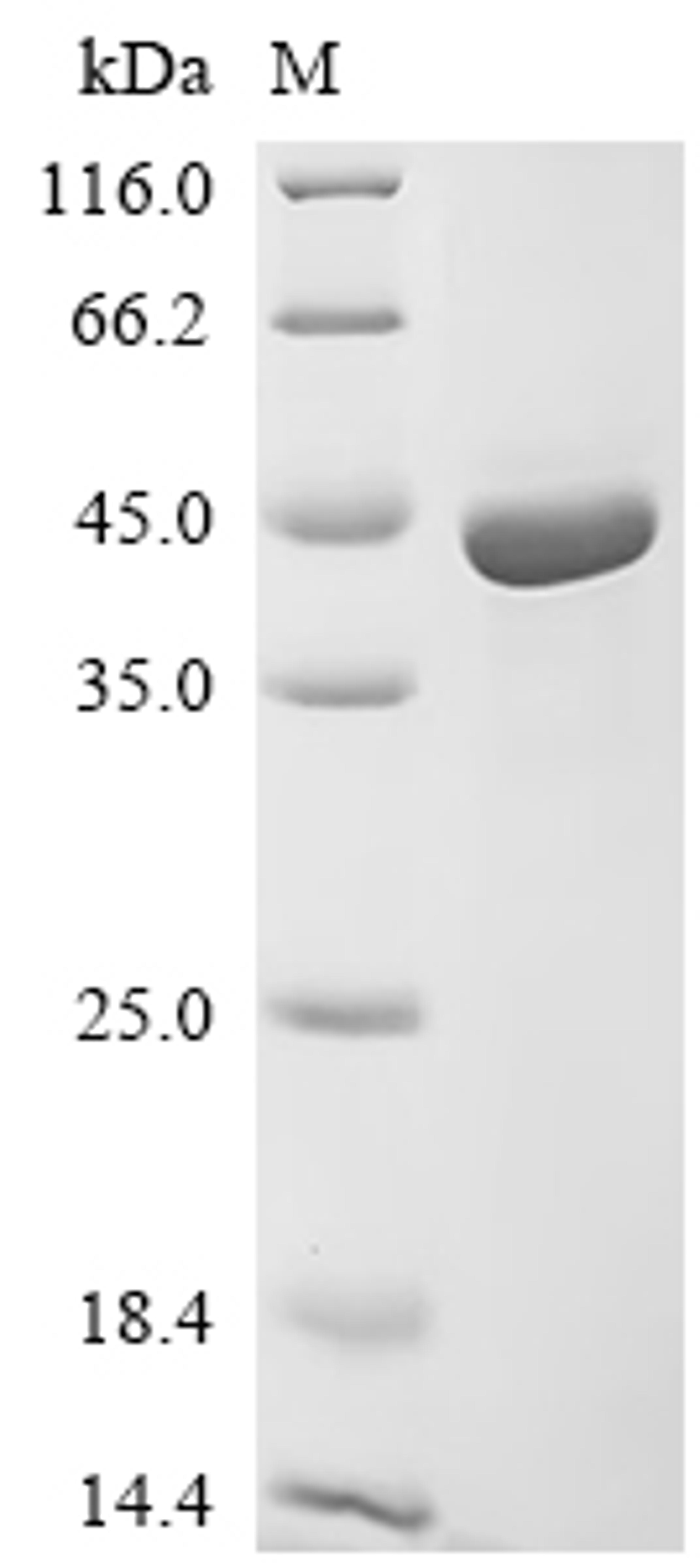 (Tris-Glycine gel) Discontinuous SDS-PAGE (reduced) with 5% enrichment gel and 15% separation gel.