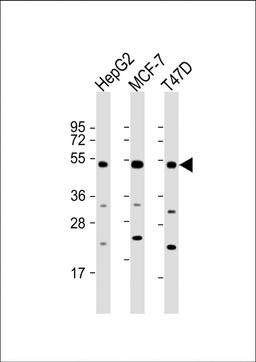 Western Blot at 1:2000 dilution Lane 1: HepG2 whole cell lysate Lane 2: MCF-7 whole cell lysate Lane 3: T47D whole cell lysate Lysates/proteins at 20 ug per lane.