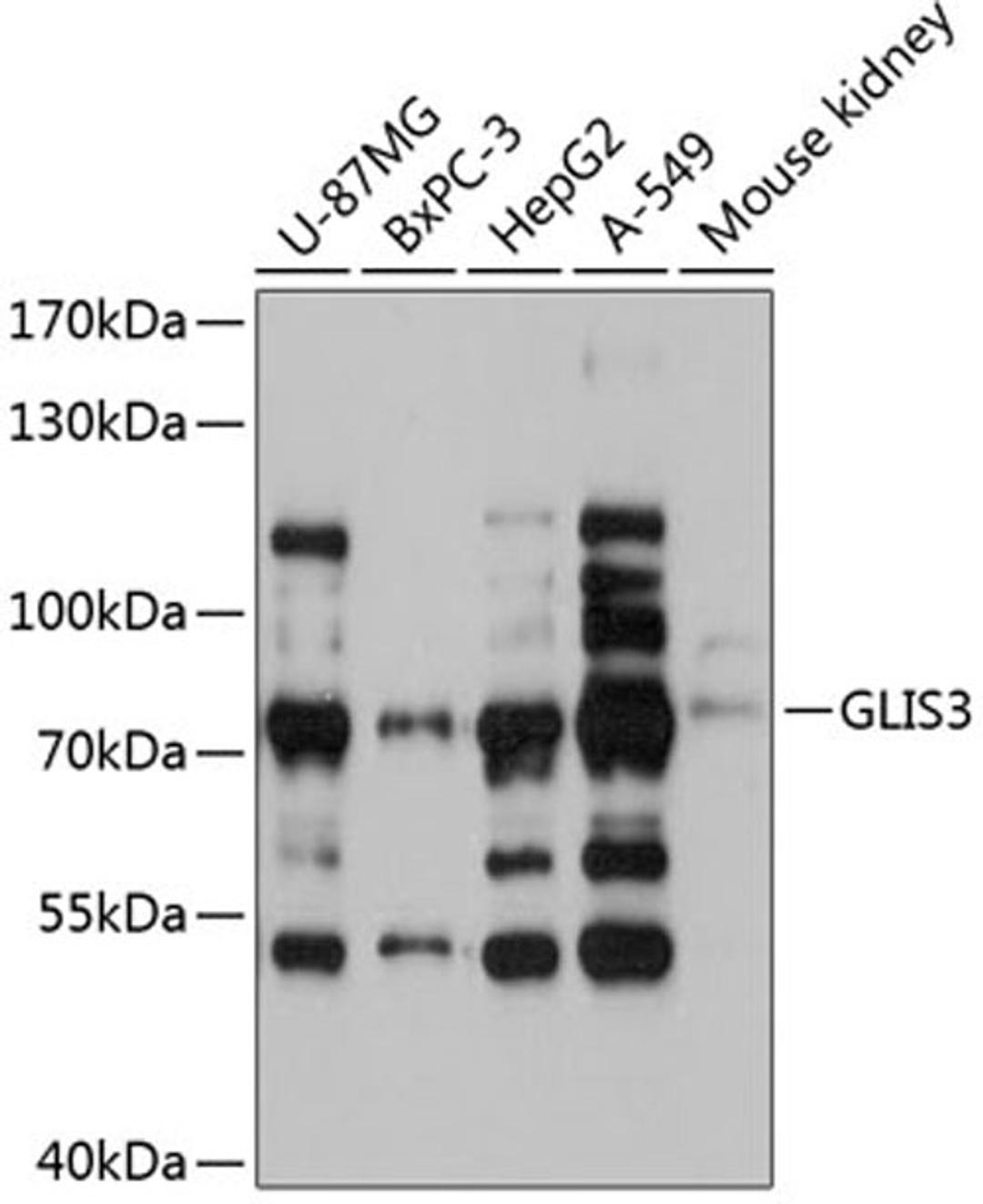 Western blot - GLIS3 antibody (A12166)