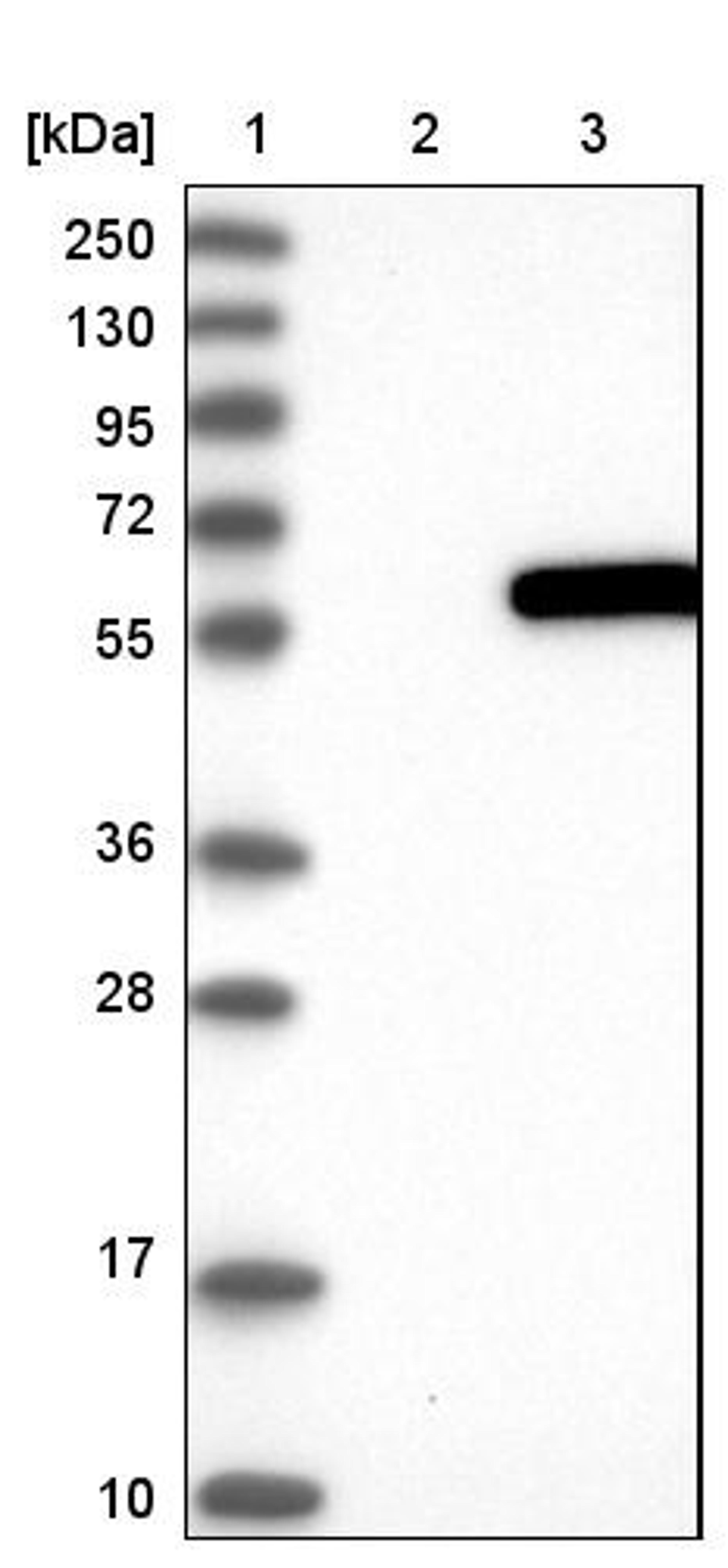 Western Blot: ATP6V1H Antibody [NBP1-85668] - Lane 1: Marker [kDa] 250, 130, 95, 72, 55, 36, 28, 17, 10<br/>Lane 2: Negative control (vector only transfected HEK293T lysate)<br/>Lane 3: Over-expression lysate (Co-expressed with a C-terminal myc-DDK tag (~3.1 kDa) in mammalian HEK293T cells, LY414295)