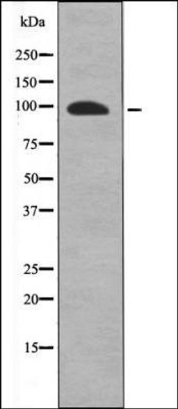 Western blot analysis of A549 whole cell lysates using FKHRL1 -Phospho-Ser318- antibody