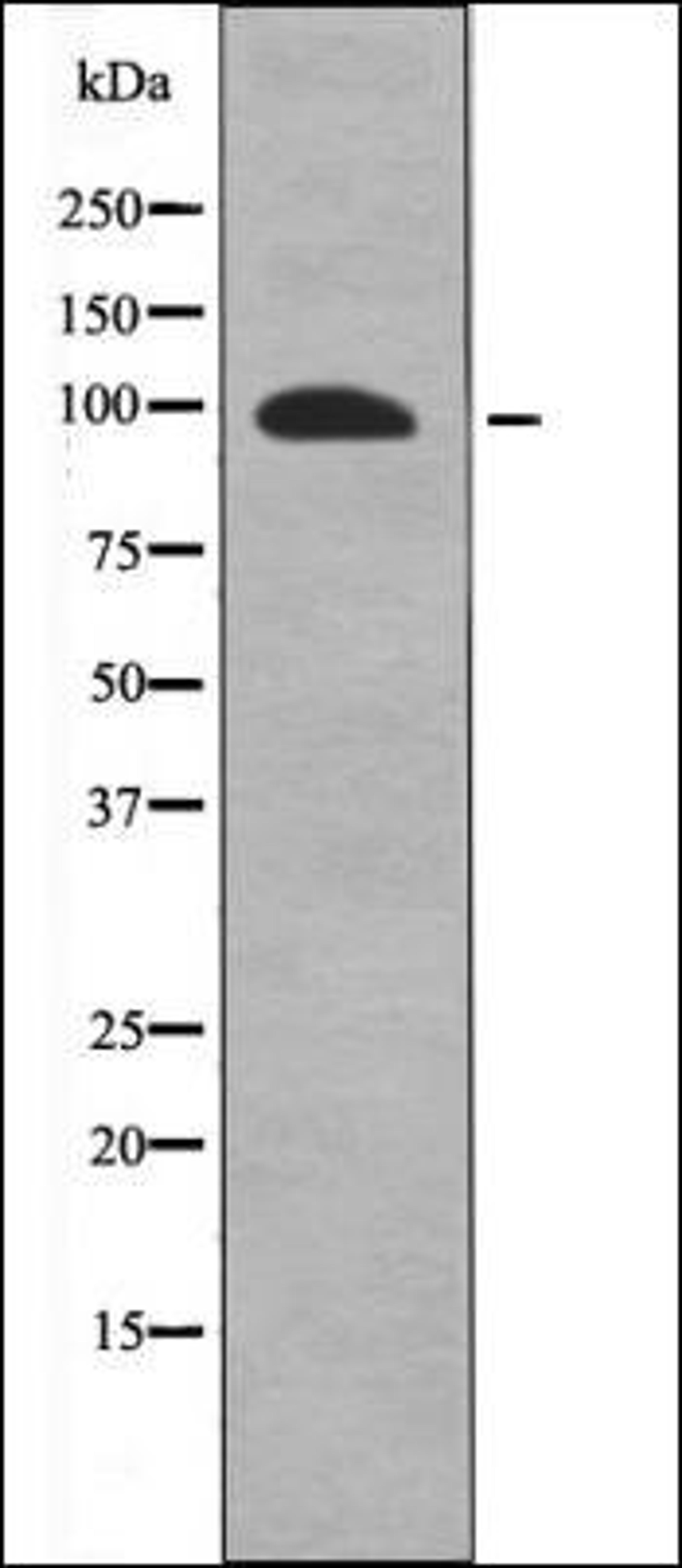 Western blot analysis of A549 whole cell lysates using FKHRL1 -Phospho-Ser318- antibody