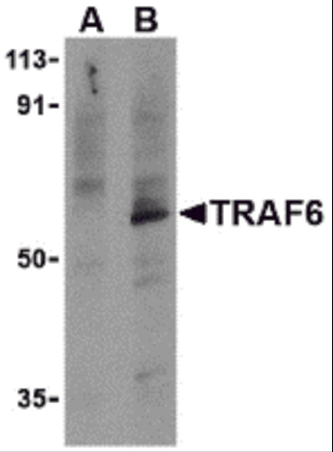 Western blot analysis of TRAF6 in PC-3 cell lysates with TRAF6 antibody at 1 &#956;g/mL in the presence (A) or absence (B) of 1 &#956;g blocking peptide. 