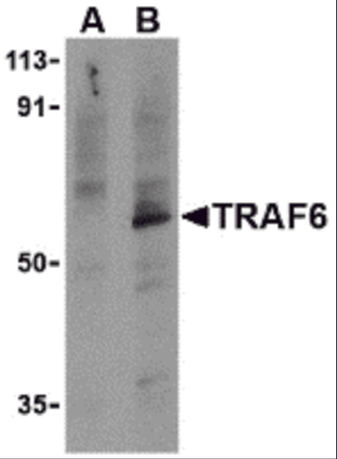 Western blot analysis of TRAF6 in PC-3 cell lysates with TRAF6 antibody at 1 μg/mL in the presence (A) or absence (B) of 1 μg blocking peptide.