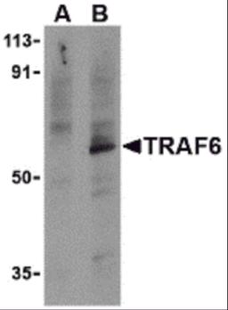 Western blot analysis of TRAF6 in PC-3 cell lysates with TRAF6 antibody at 1 μg/mL in the presence (A) or absence (B) of 1 μg blocking peptide.