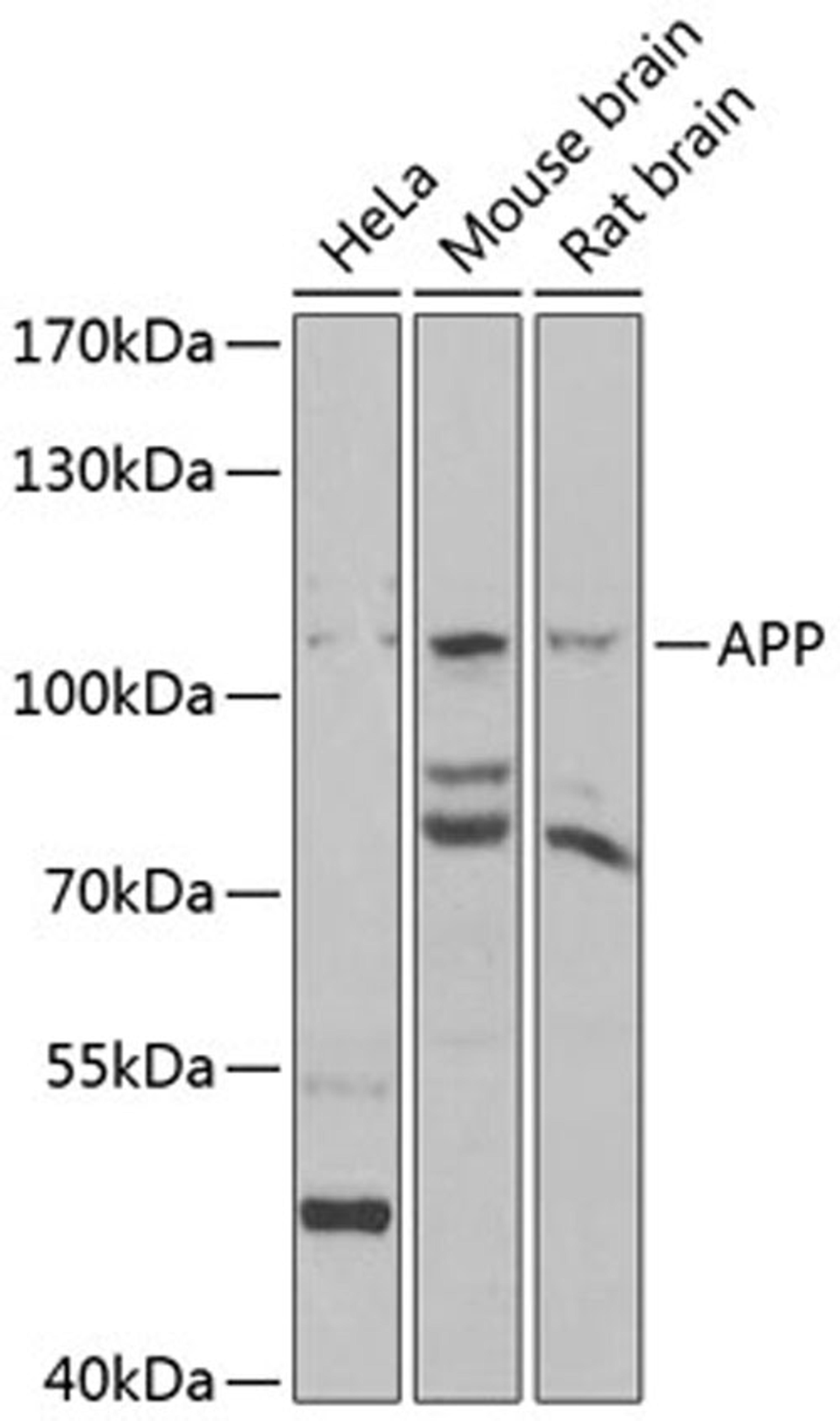 Western blot - APP antibody (A11019)