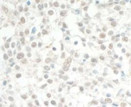 Detection of human MED13L by immunohistochemistry.